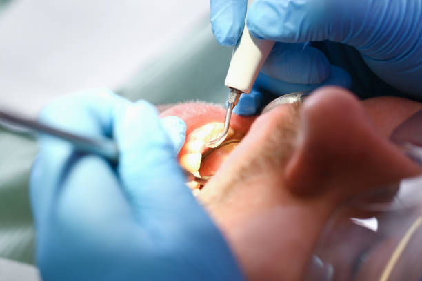 Best Emergency Dental Care for Broken or Chipped Teeth in Mogul, NV