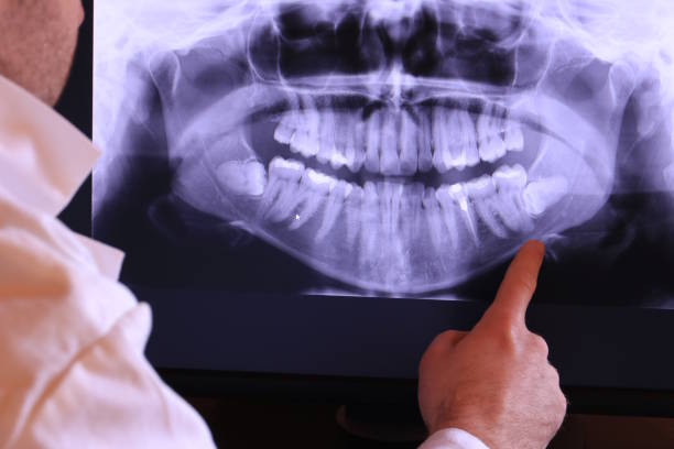 Best Emergency Wisdom Teeth Removal in Mogul, NV