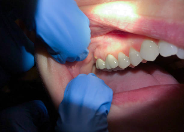 Best Emergency Tooth Extraction in Mogul, NV