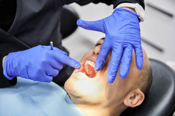 Best Emergency Treatment for Dental Infections or Abscesses in Mogul, NV