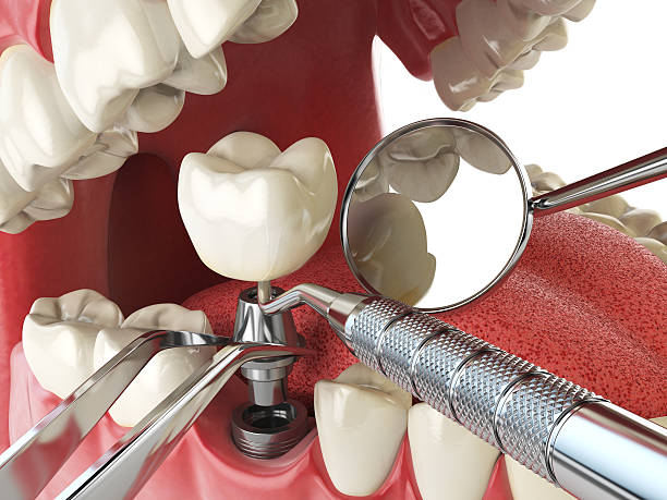 Best Emergency Gum Treatment in Mogul, NV